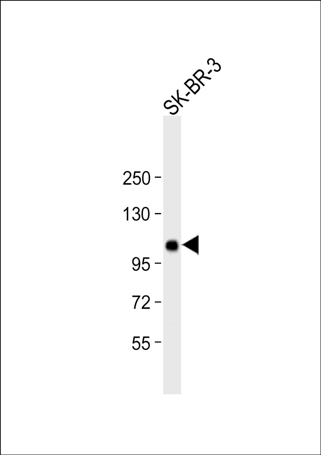 Western Blot at 1:1000 dilution + SK-BR-3 whole cell lysate Lysates/proteins at 20 ug per lane.