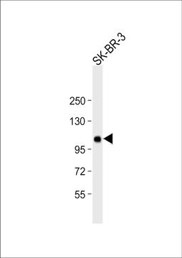 Western Blot at 1:1000 dilution + SK-BR-3 whole cell lysate Lysates/proteins at 20 ug per lane.