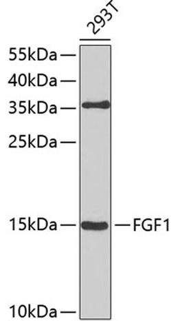 Western blot - FGF1 antibody (A0685)