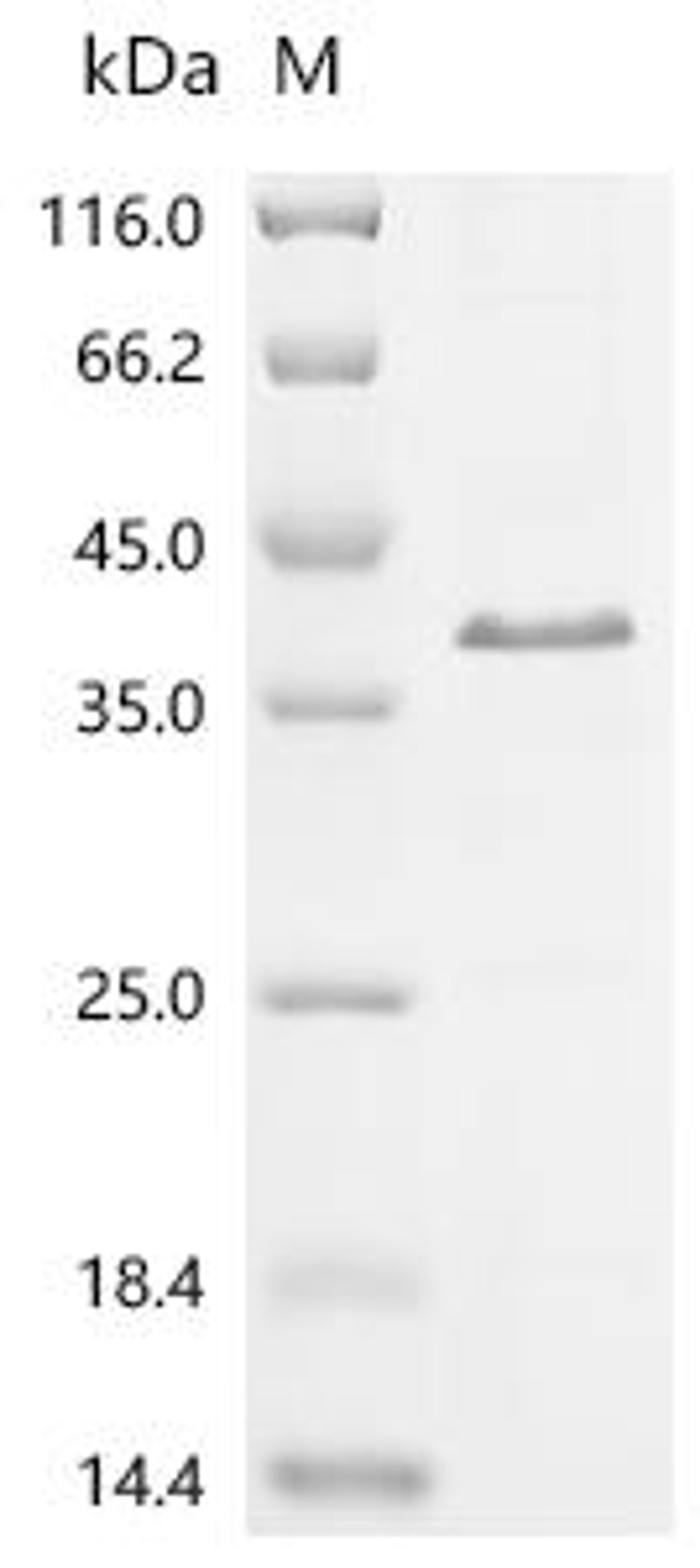 (Tris-Glycine gel) Discontinuous SDS-PAGE (reduced) with 5% enrichment gel and 15% separation gel.
