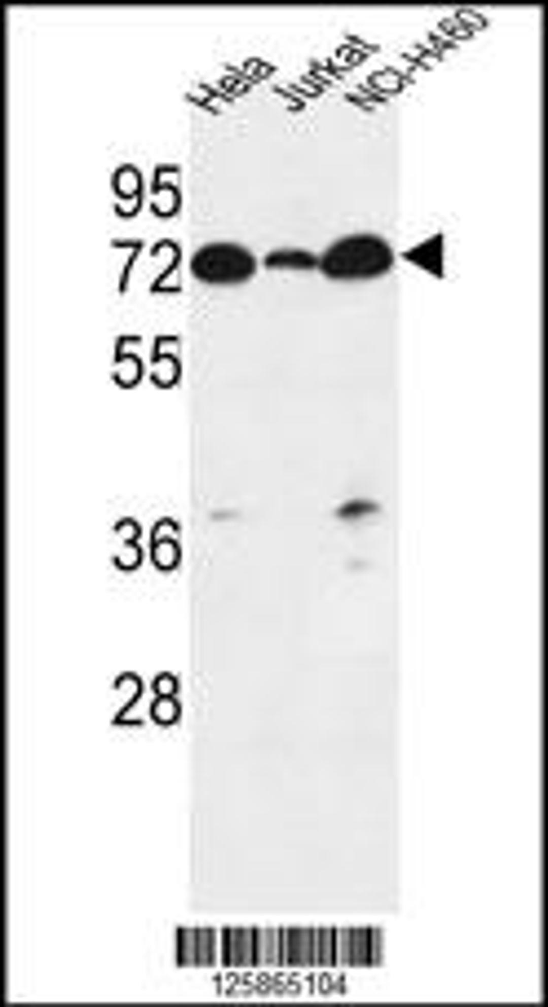 Western blot analysis in Hela,Jurkat,NCI-H460 cell line lysates (35ug/lane).