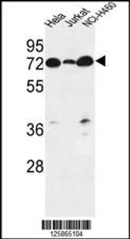 Western blot analysis in Hela,Jurkat,NCI-H460 cell line lysates (35ug/lane).