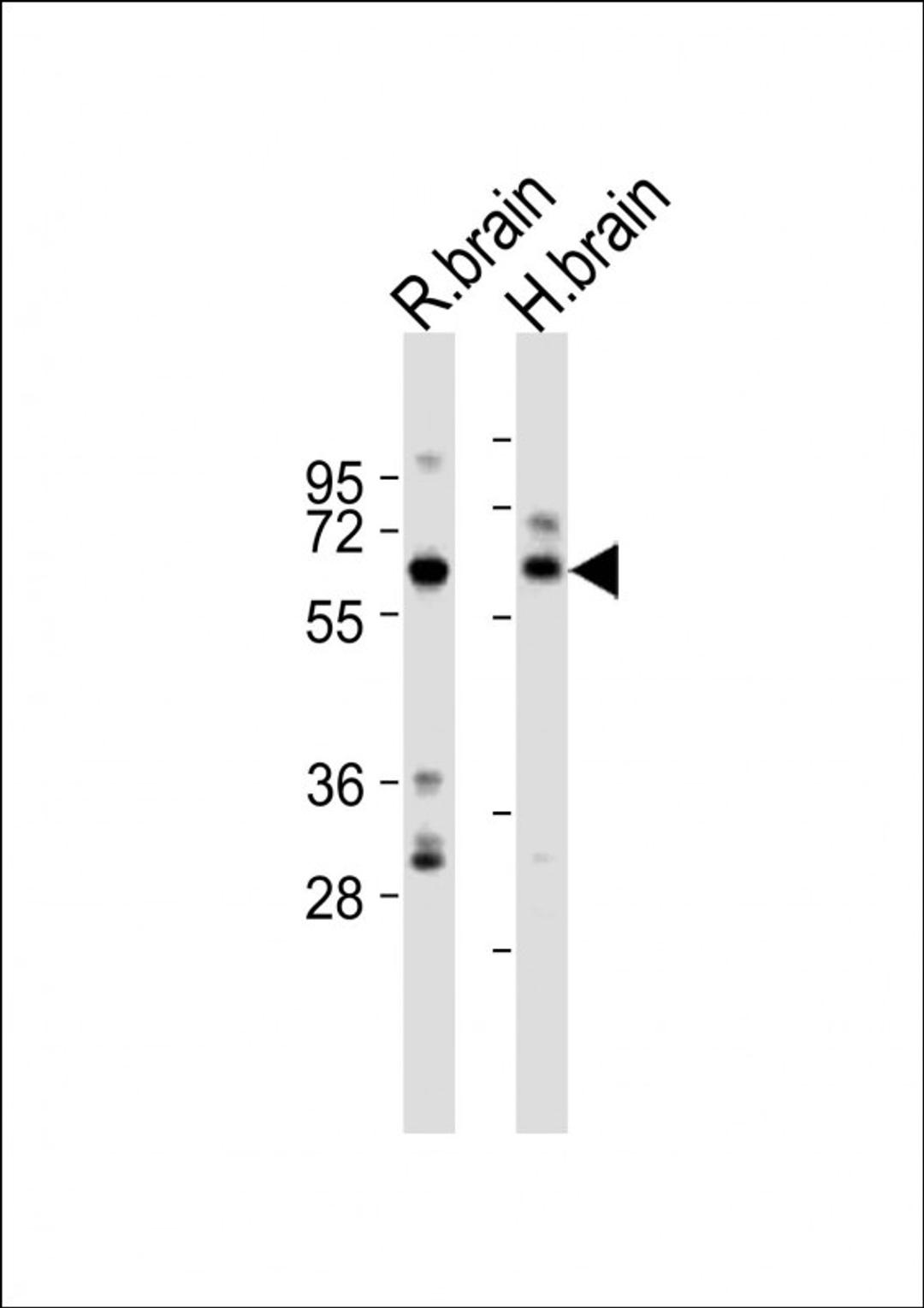 Western Blot at 1:2000 dilution Lane 1: rat brain lysates Lane 2: human brain lysates Lysates/proteins at 20 ug per lane.