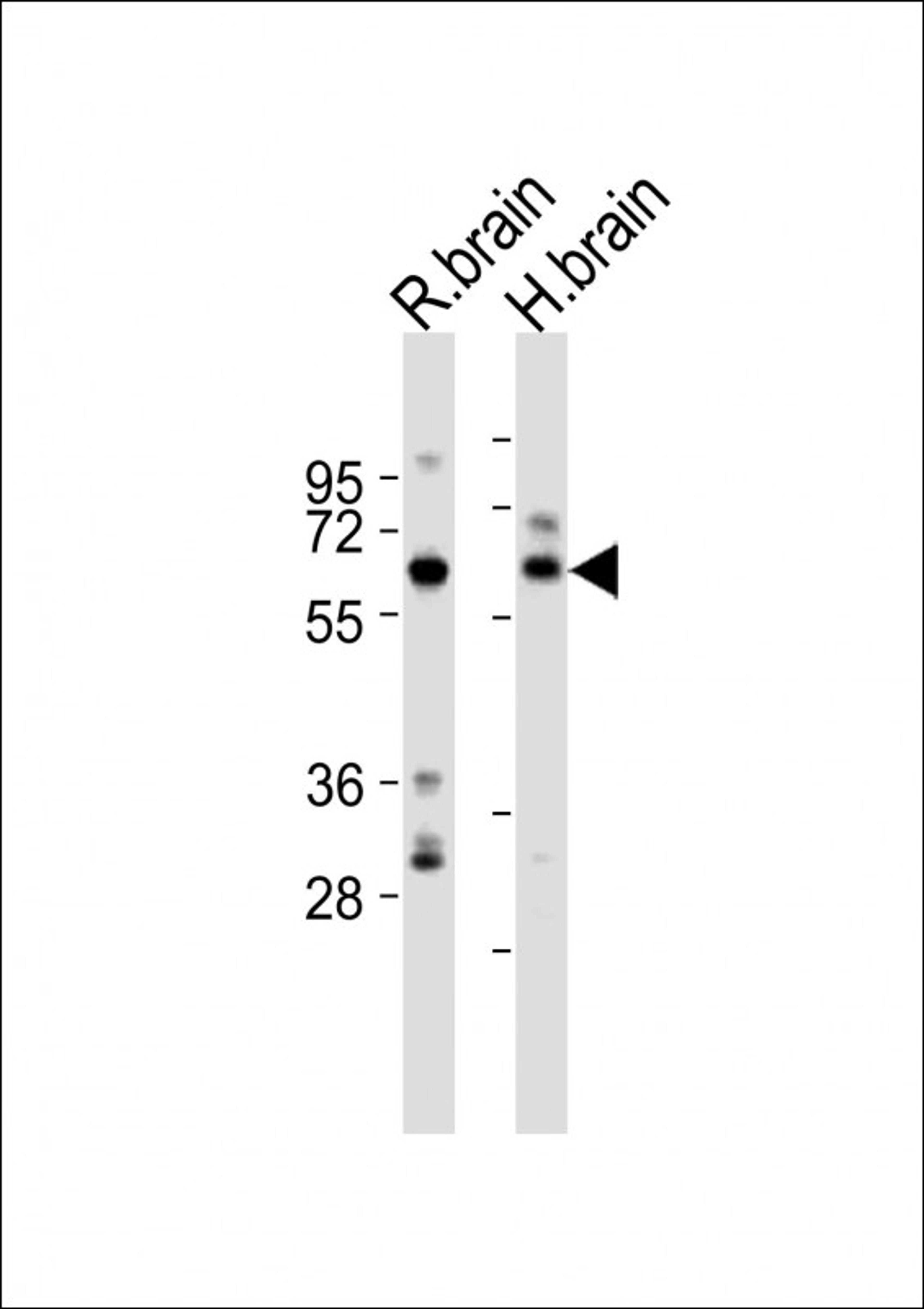 Western Blot at 1:2000 dilution Lane 1: rat brain lysates Lane 2: human brain lysates Lysates/proteins at 20 ug per lane.