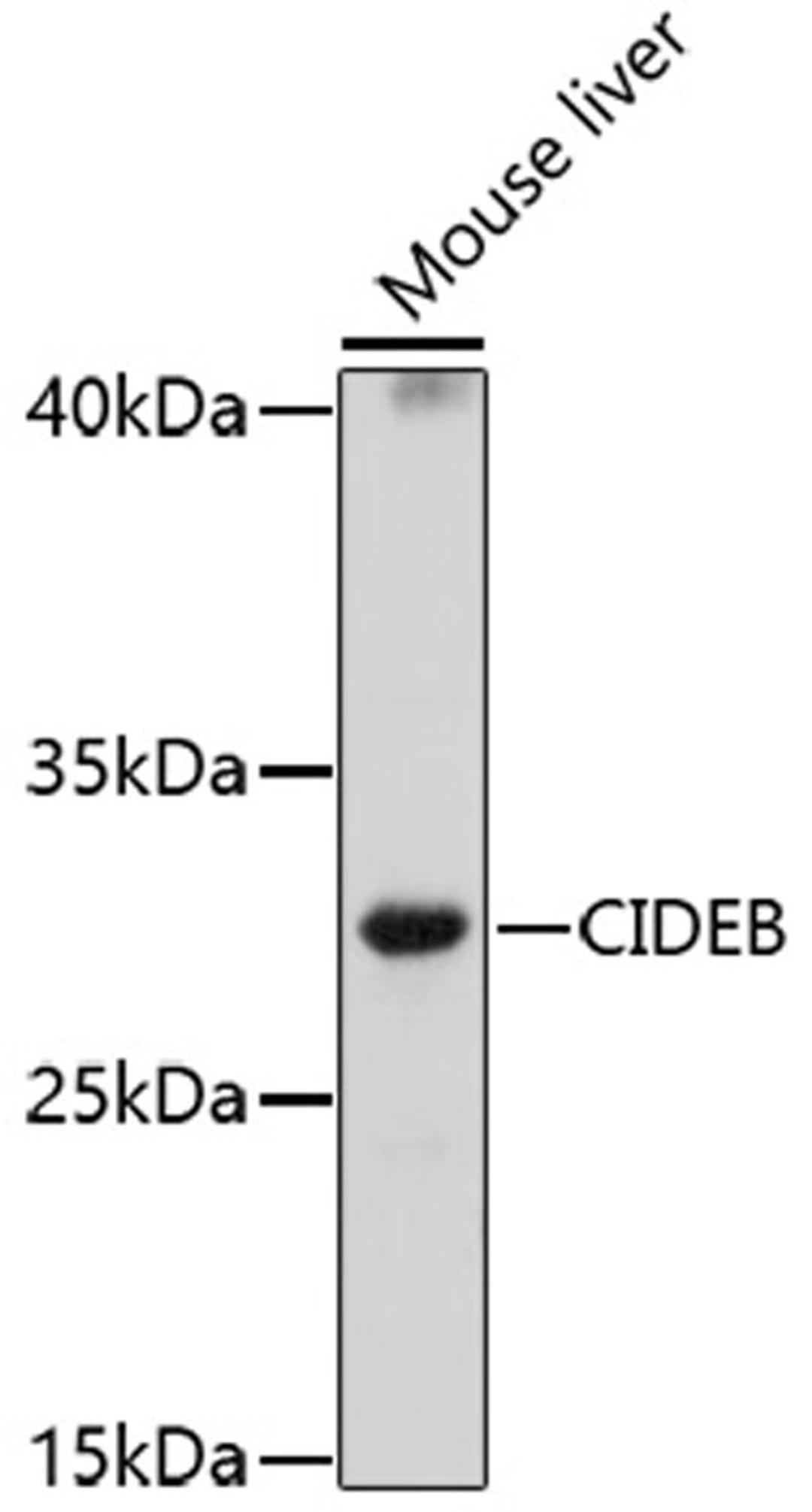 Western blot - CIDEB antibody (A17141)