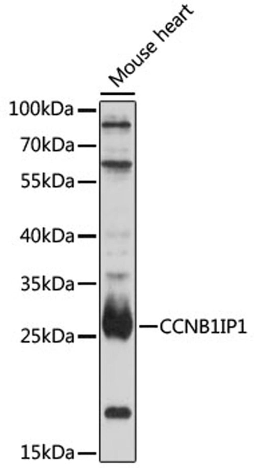 Western blot - CCNB1IP1 antibody (A16693)