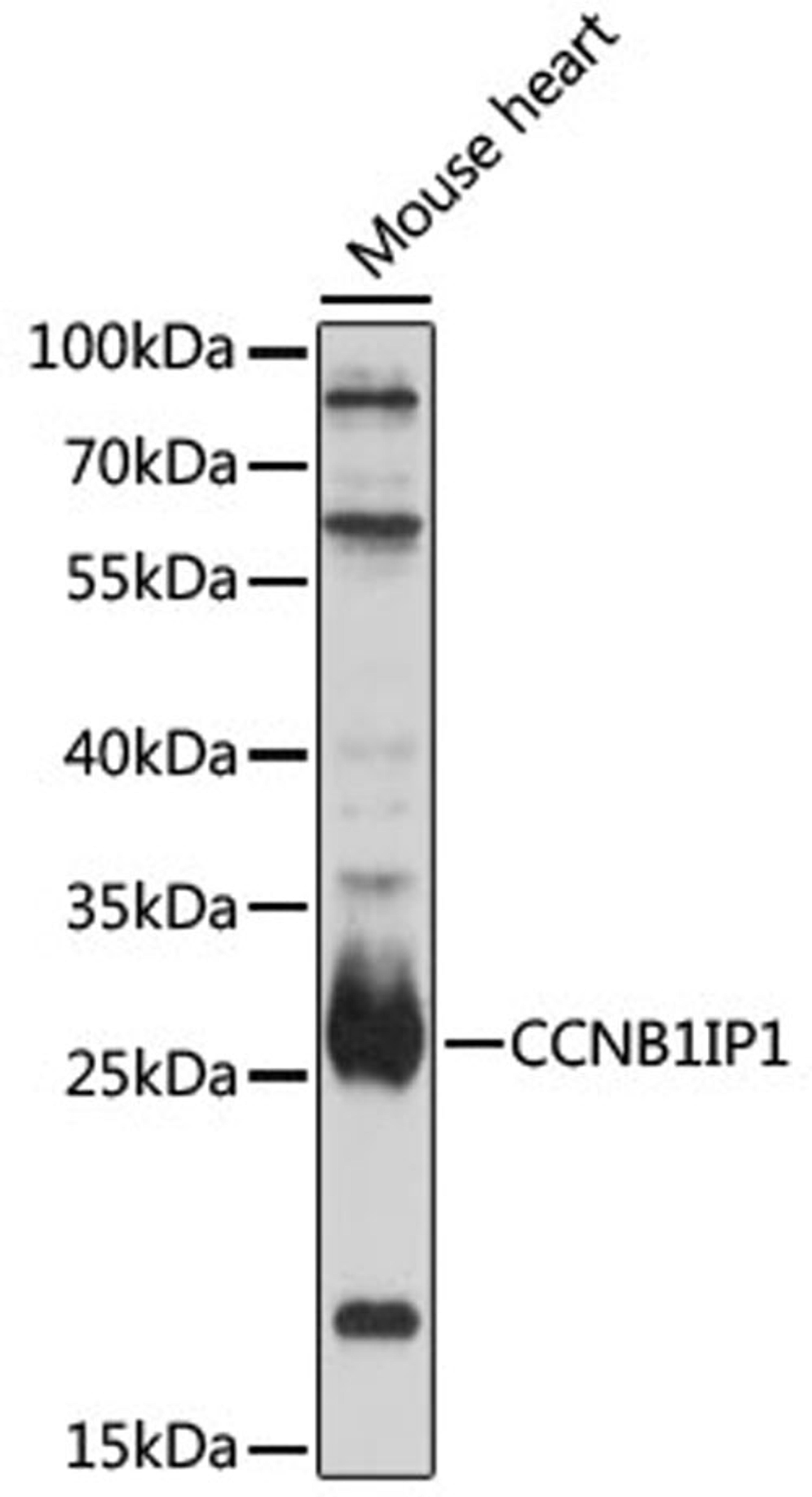 Western blot - CCNB1IP1 antibody (A16693)