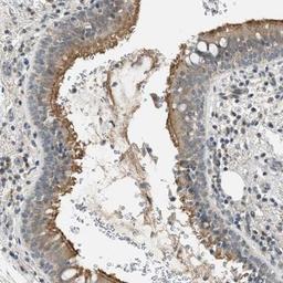 Immunohistochemistry: Tau tubulin kinase 2 Antibody [NBP1-92476] - Staining of human bronchus shows moderate cytoplasmic and membranous positivity in respiratory epithelial cells.