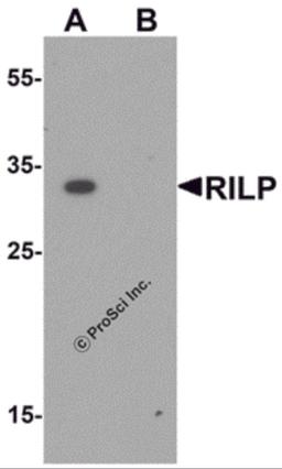 Western blot analysis of RILP in A20 cell lysate with RILP antibody at 1 &#956;g/mL.