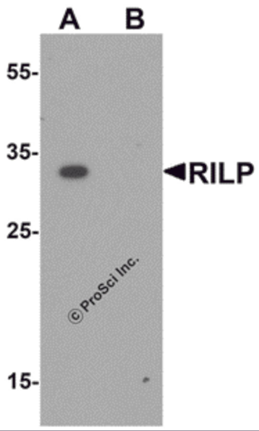 Western blot analysis of RILP in A20 cell lysate with RILP antibody at 1 μg/mL.