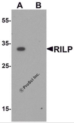 Western blot analysis of RILP in A20 cell lysate with RILP antibody at 1 μg/mL.
