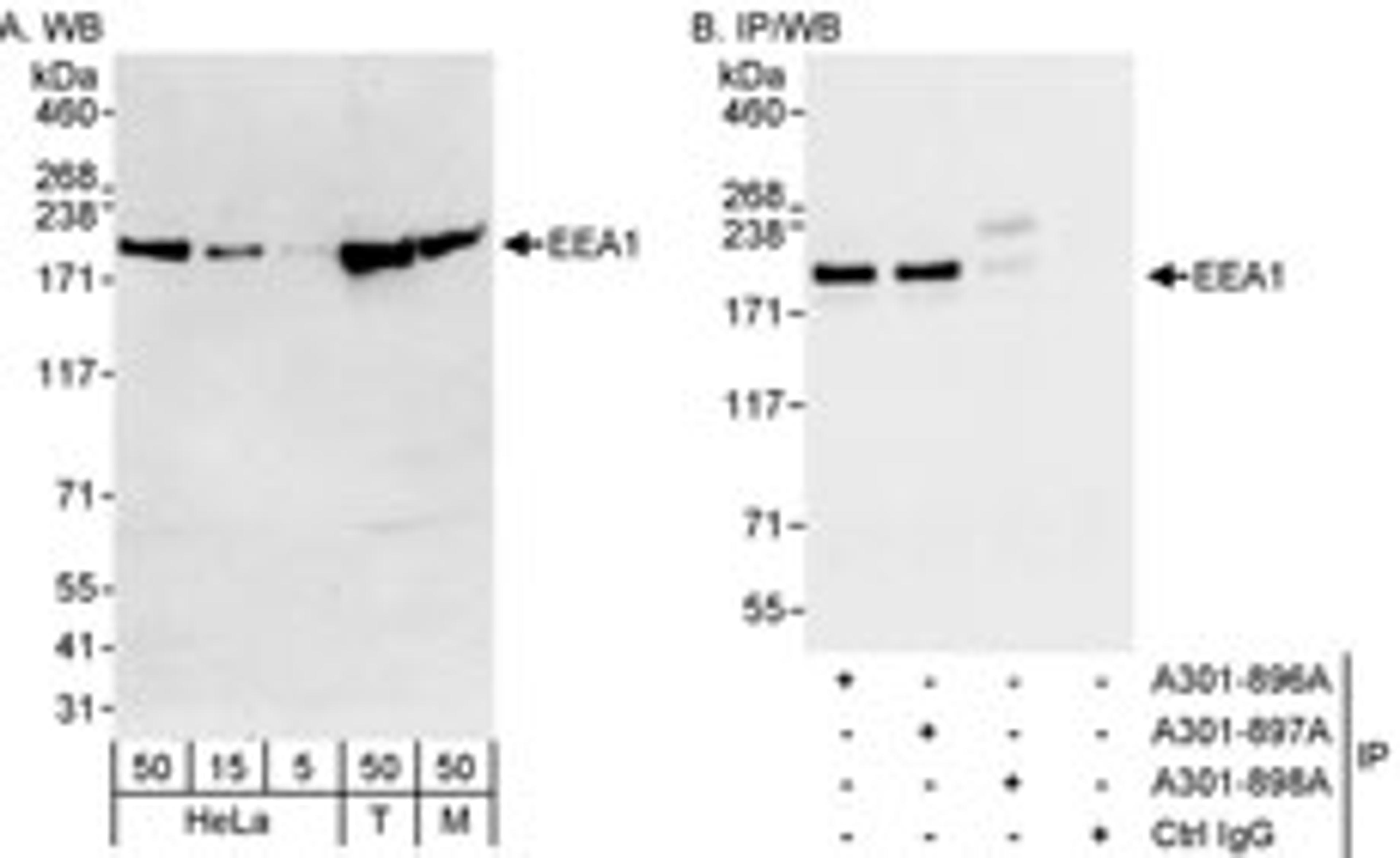 Detection of human and mouse EEA1 by western blot (h&m) and immunoprecipitation (h).