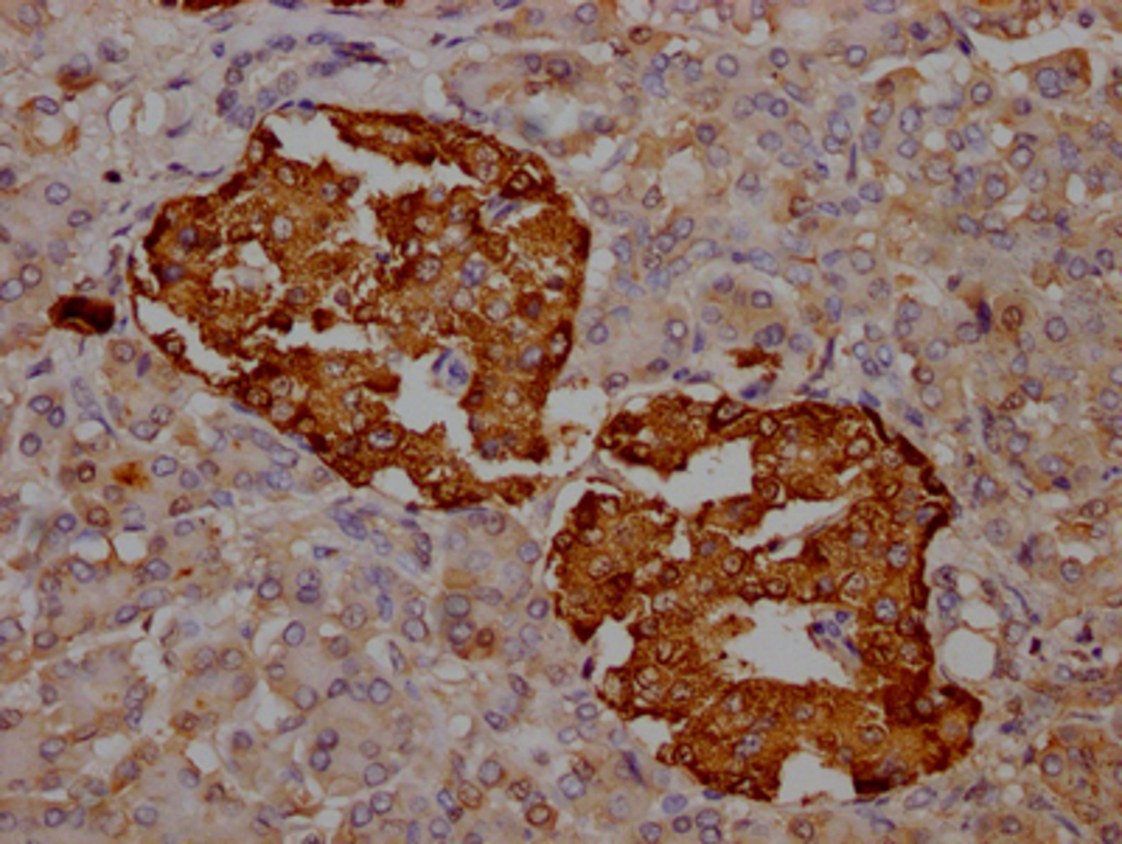 IHC image of CSB-RA588381A0HU diluted at 1:100 and staining in paraffin-embedded human pancreatic tissue performed on a Leica BondTM system. After dewaxing and hydration, antigen retrieval was mediated by high pressure in a citrate buffer (pH 6.0). Section was blocked with 10% normal goat serum 30min at RT. Then primary antibody (1% BSA) was incubated at 4℃ overnight. The primary is detected by a Goat anti-rabbit IgG polymer labeled by HRP and visualized using 0.05% DAB.