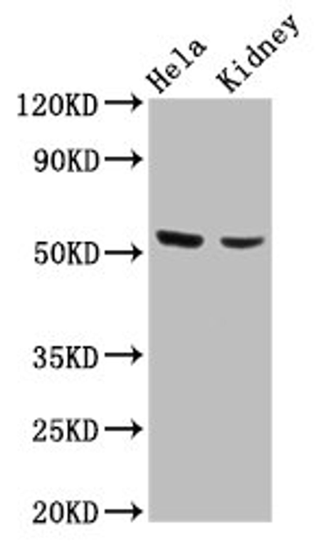 Western Blot. Positive WB detected in: Hela whole cell lysate, Mouse kidney tissue. All lanes: POLK antibody at 4.2µg/ml. Secondary. Goat polyclonal to rabbit IgG at 1/50000 dilution. Predicted band size: 99, 55, 77, 43, 56, 53, 89 kDa. Observed band size: 53 kDa