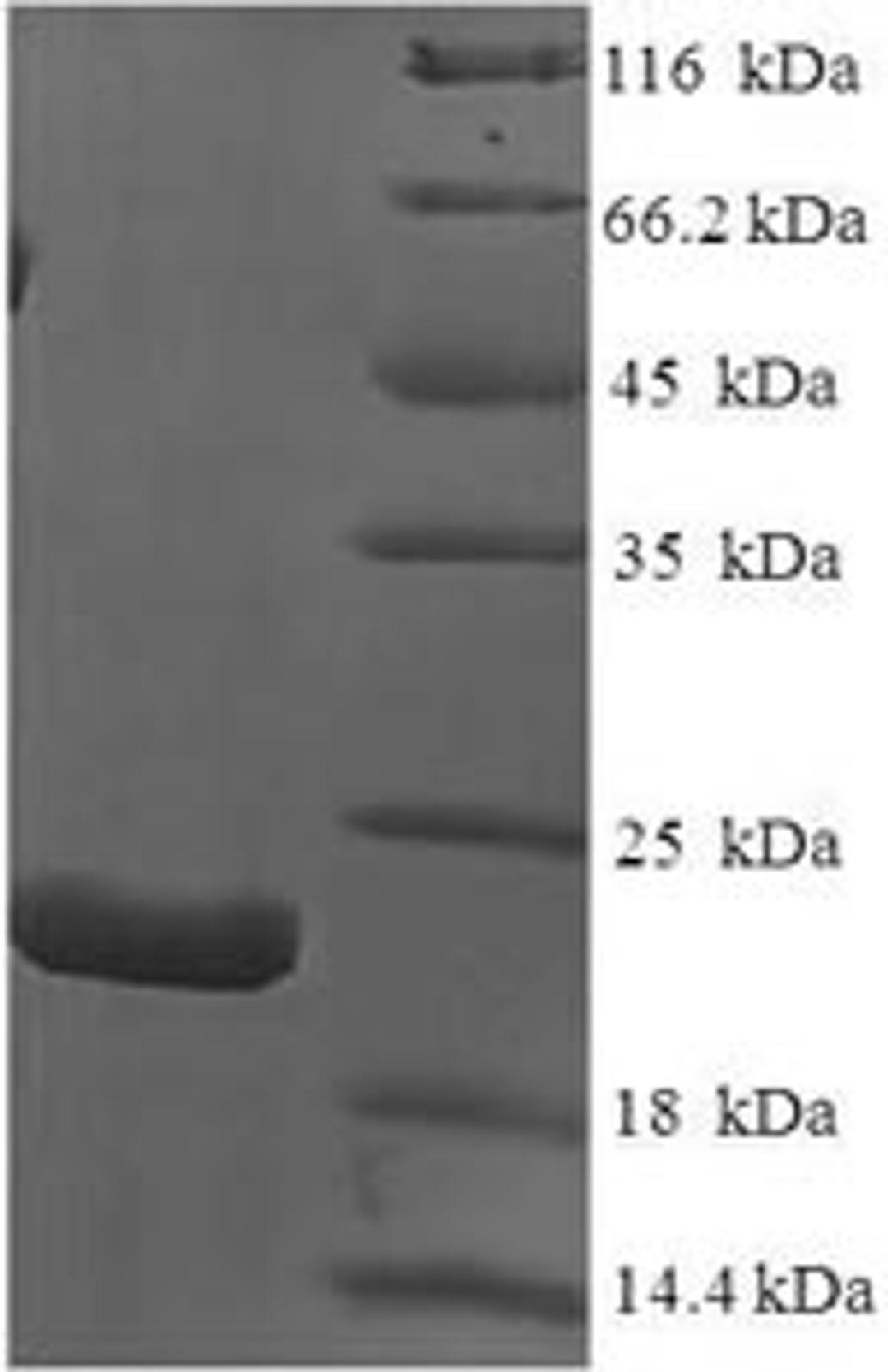 (Tris-Glycine gel) Discontinuous SDS-PAGE (reduced) with 5% enrichment gel and 15% separation gel.