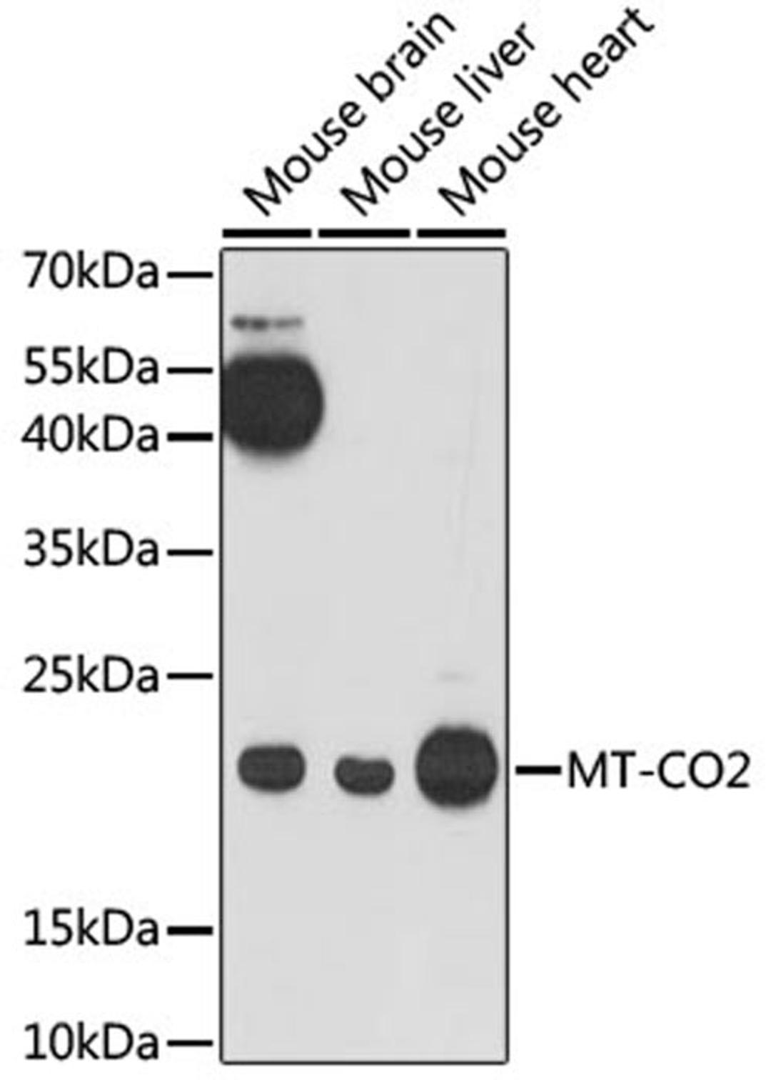 Western blot - MT-CO2 antibody (A17965)