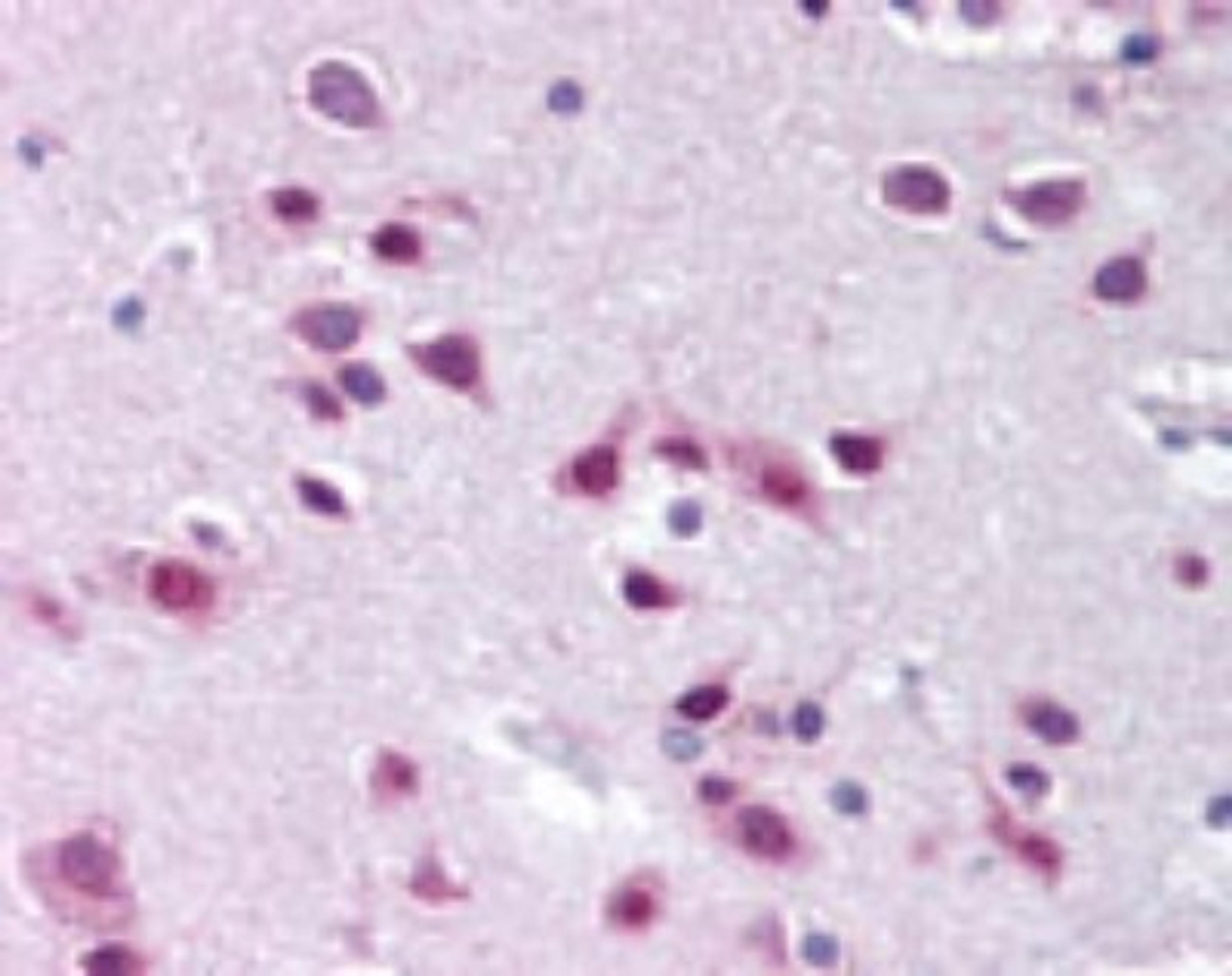 Immunohistochemistry-Paraffin: FLJ10808 Antibody [NBP2-24587] - analysis of UBA6 in human brain, cortex, using UBA6 antibody at 10 ug/ml.