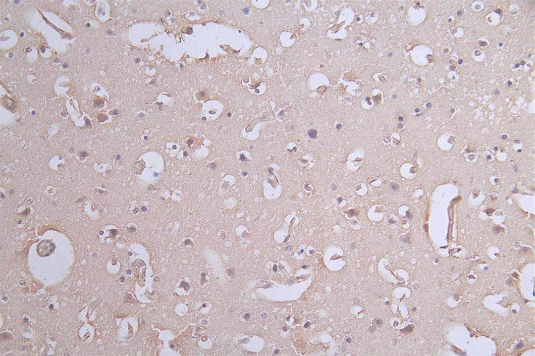 IHC image of CSB-RA017450A0HU diluted at 1:50 and staining in paraffin-embedded human brain tissue performed on a Leica BondTM system. After dewaxing and hydration, antigen retrieval was mediated by high pressure in a citrate buffer (pH 6.0). Section was blocked with 10% normal goat serum 30min at RT. Then primary antibody (1% BSA) was incubated at 4°C overnight. The primary is detected by a Goat anti-rabbit polymer IgG labeled by HRP and visualized using 0.62% DAB.