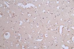 IHC image of CSB-RA017450A0HU diluted at 1:50 and staining in paraffin-embedded human brain tissue performed on a Leica BondTM system. After dewaxing and hydration, antigen retrieval was mediated by high pressure in a citrate buffer (pH 6.0). Section was blocked with 10% normal goat serum 30min at RT. Then primary antibody (1% BSA) was incubated at 4°C overnight. The primary is detected by a Goat anti-rabbit polymer IgG labeled by HRP and visualized using 0.62% DAB.