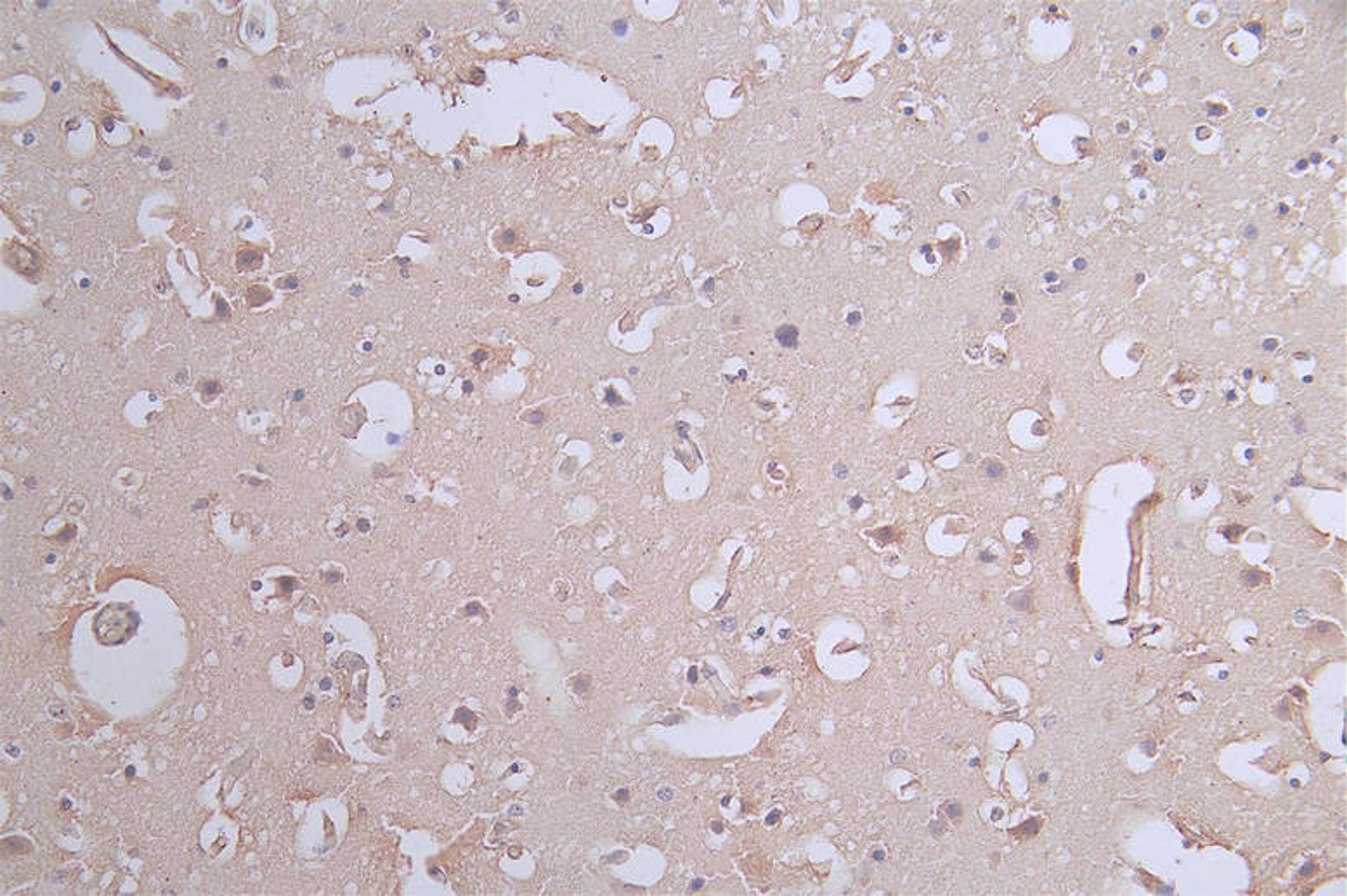 IHC image of CSB-RA017450A0HU diluted at 1:50 and staining in paraffin-embedded human brain tissue performed on a Leica BondTM system. After dewaxing and hydration, antigen retrieval was mediated by high pressure in a citrate buffer (pH 6.0). Section was blocked with 10% normal goat serum 30min at RT. Then primary antibody (1% BSA) was incubated at 4°C overnight. The primary is detected by a Goat anti-rabbit polymer IgG labeled by HRP and visualized using 0.62% DAB.