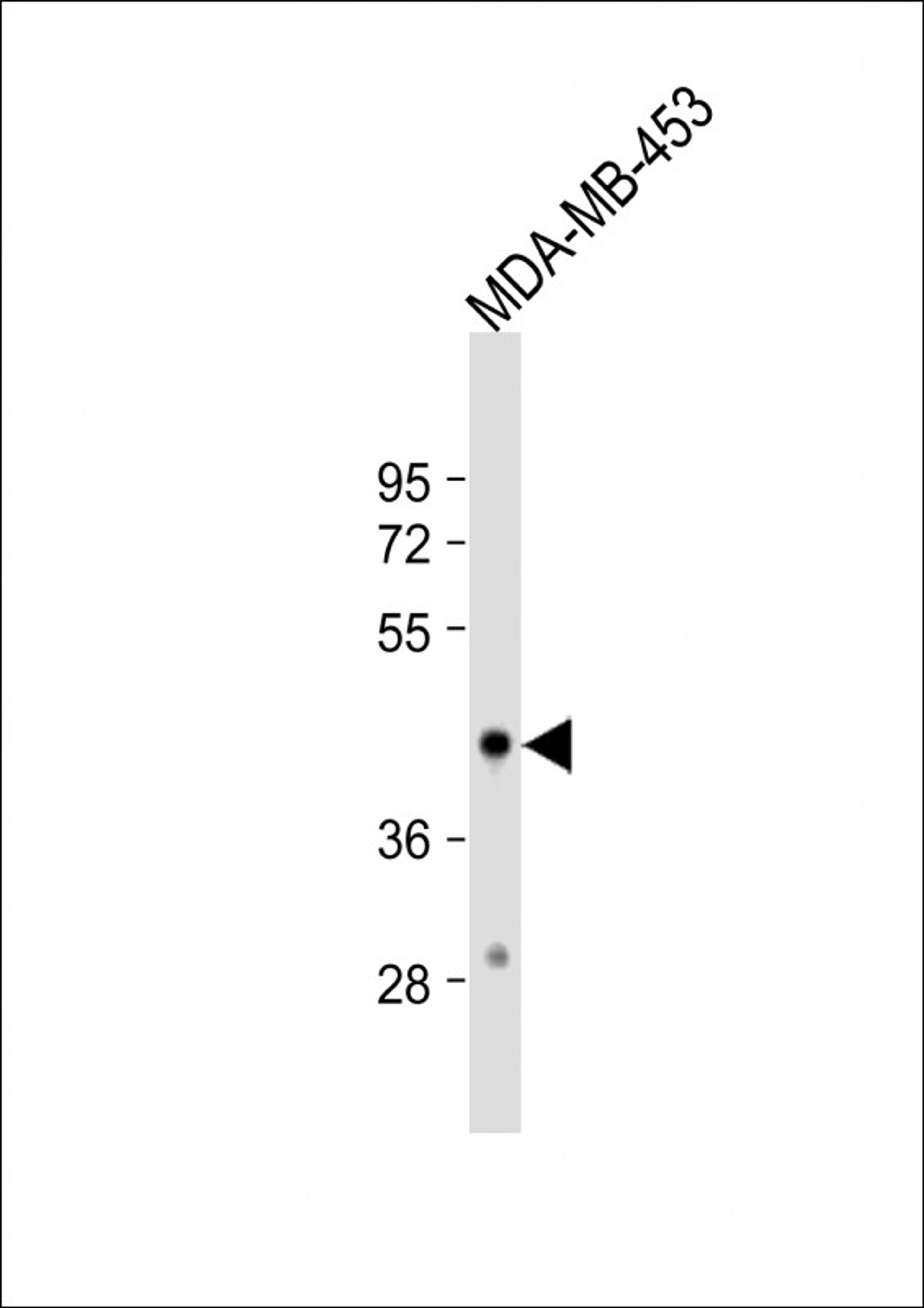 Western Blot at 1:1000 dilution + MDA-MB-453 whole cell lysate Lysates/proteins at 20 ug per lane.