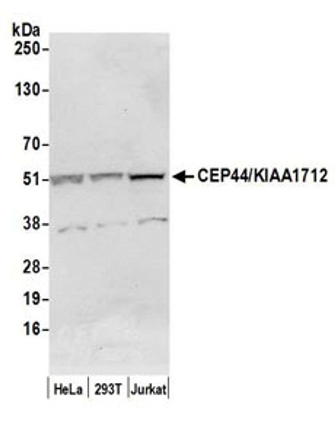 Detection of human CEP44/KIAA1712 by western blot.