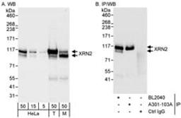 Detection of human and mouse XRN2 by western blot (h&m) and immunoprecipitation (h).