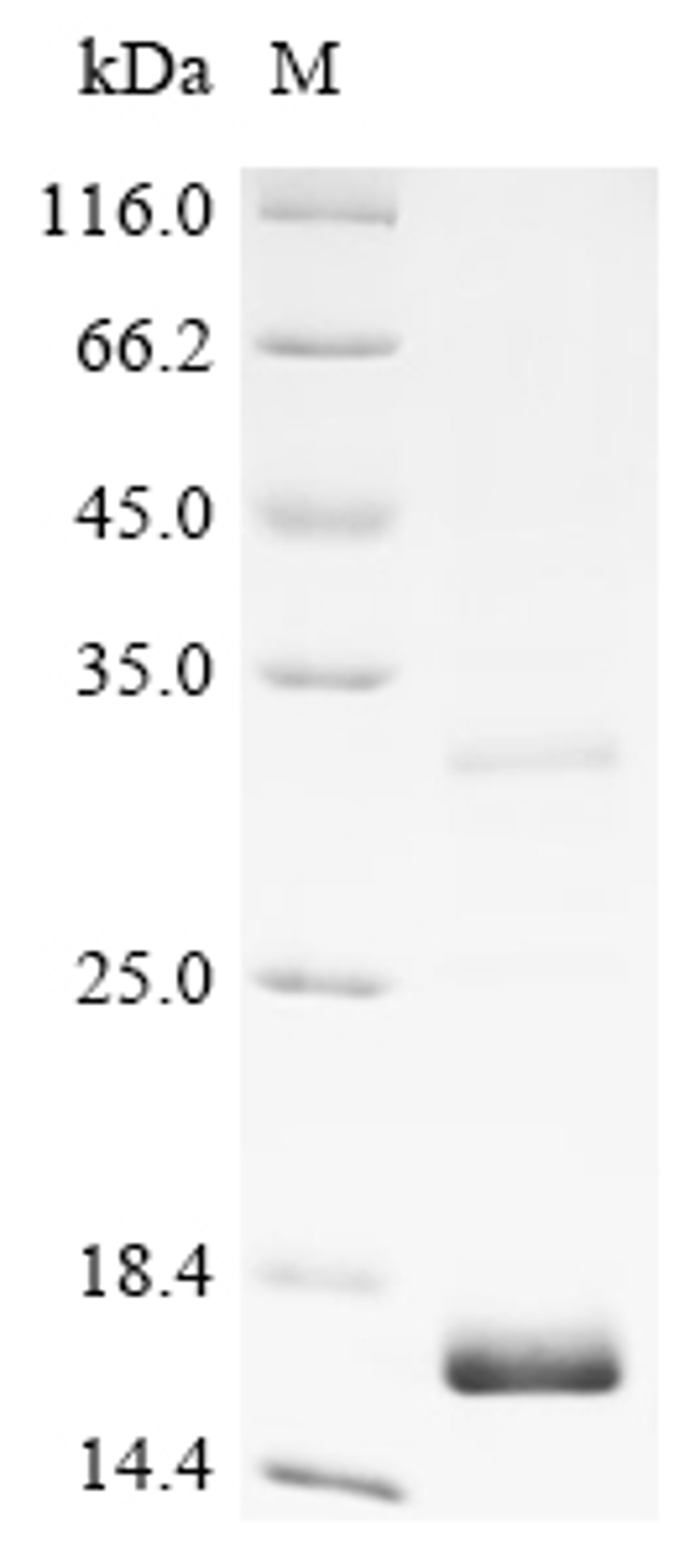 (Tris-Glycine gel) Discontinuous SDS-PAGE (reduced) with 5% enrichment gel and 15% separation gel.