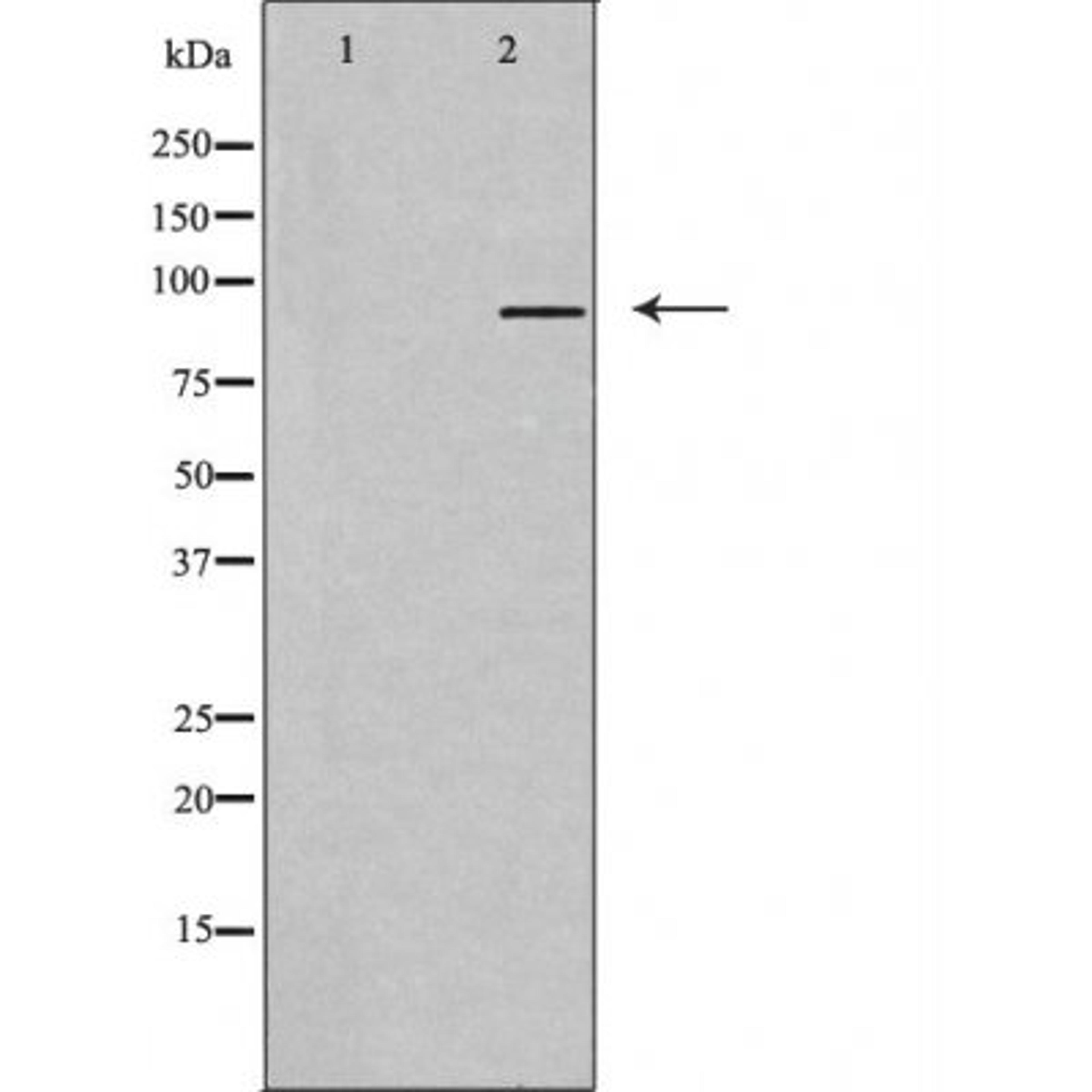 Western blot analysis of Jurkat cells using TAS1R3 antibody