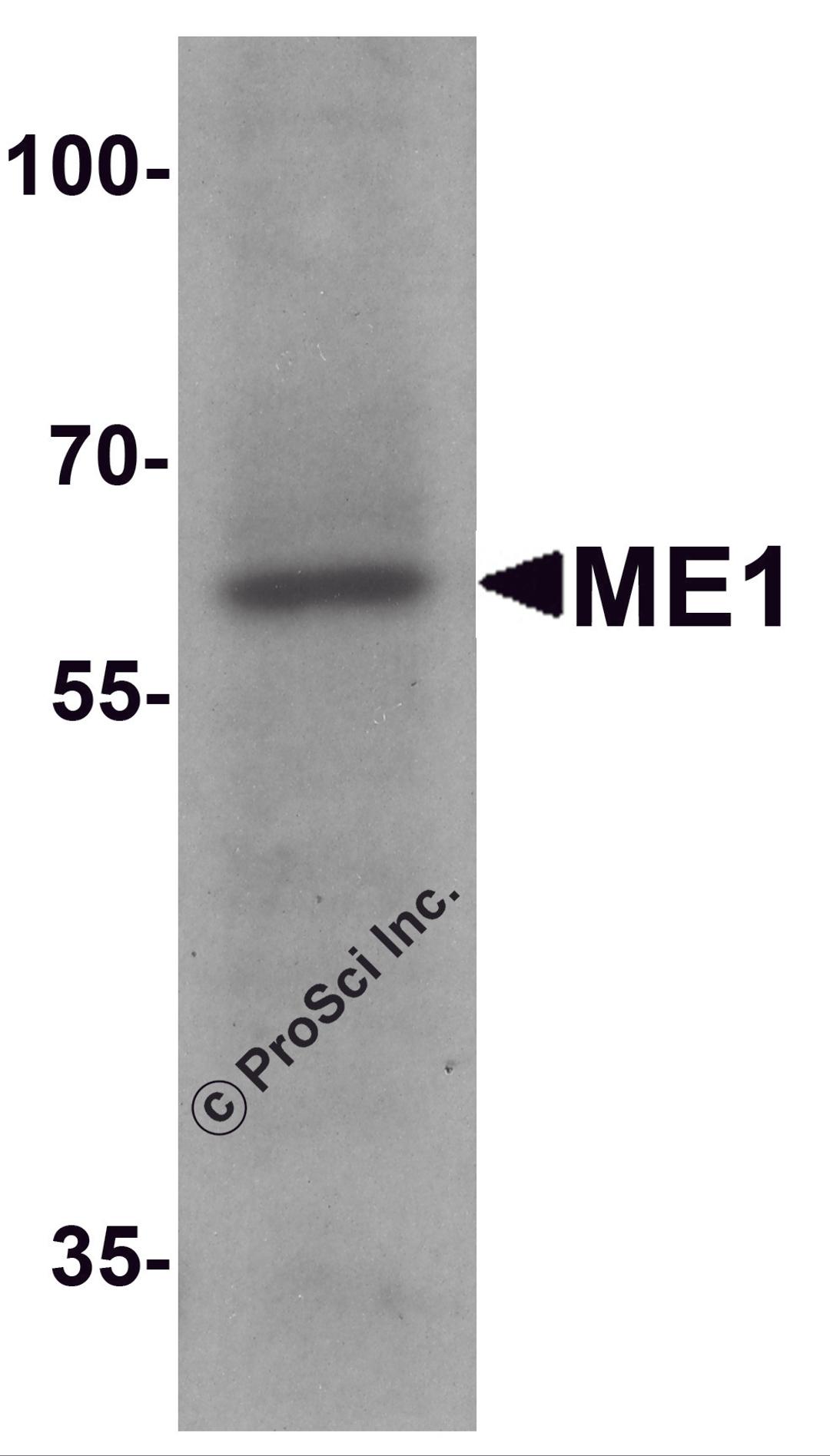 Western blot analysis of ME1 in 293 cell lysate with ME1 antibody at 1 μg/ml.