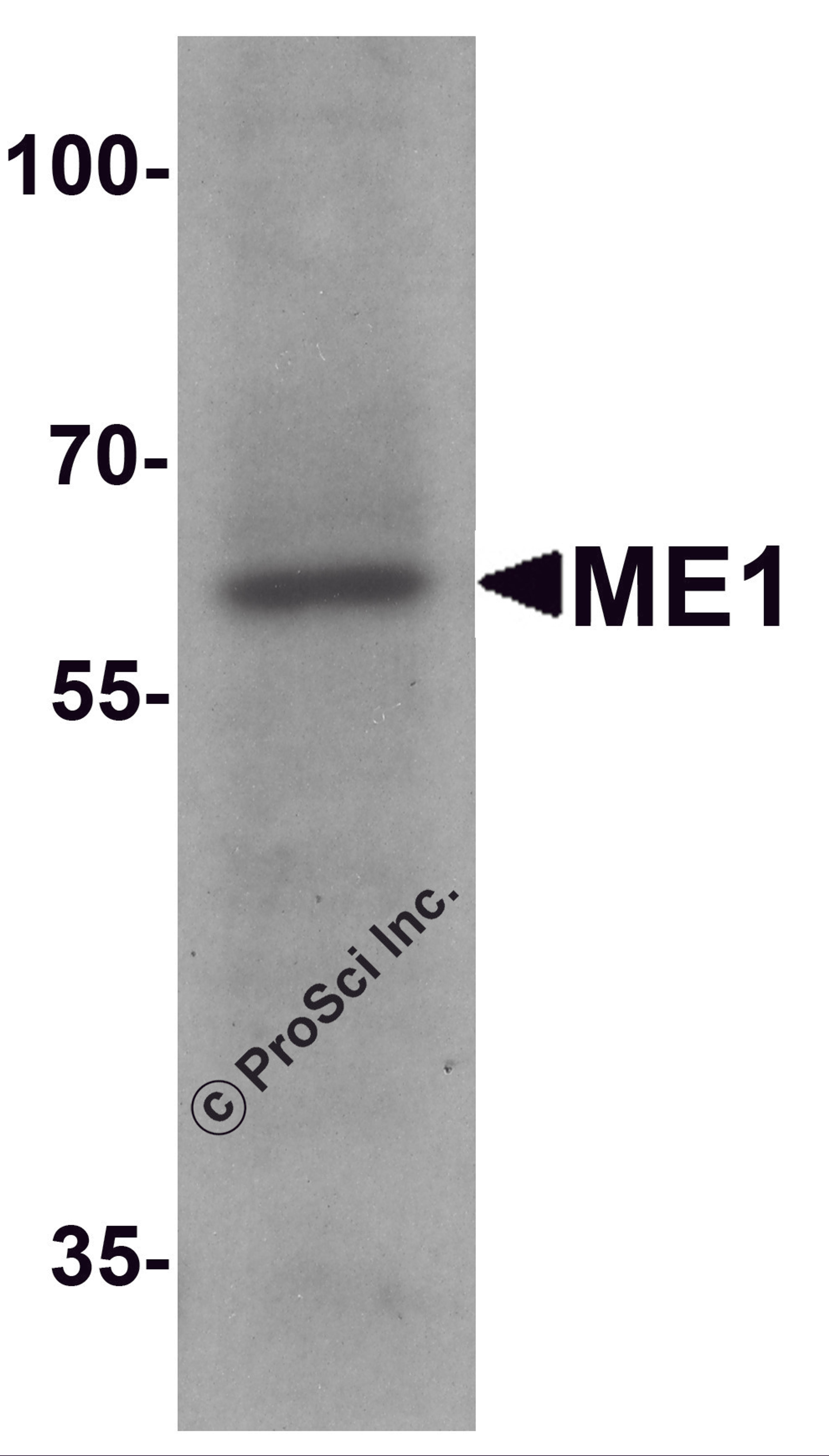 Western blot analysis of ME1 in 293 cell lysate with ME1 antibody at 1 μg/ml.
