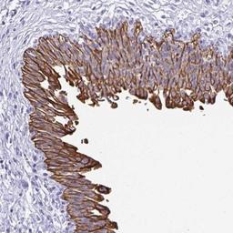 Immunohistochemistry: CPEB1 Antibody [NBP2-32350] - Staining of human urinary bladder shows strong membranous and cytoplasmic positivity in urothelial cells.