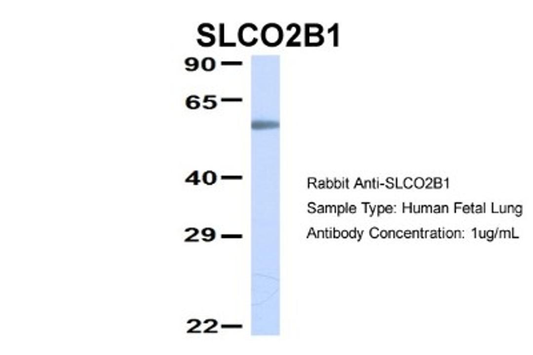 Western Blot: SLCO2B1 Antibody [NBP1-59811] - Human Fetal Lung, Antibody Dilution: 1.0 ug/ml.