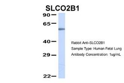 Western Blot: SLCO2B1 Antibody [NBP1-59811] - Human Fetal Lung, Antibody Dilution: 1.0 ug/ml.