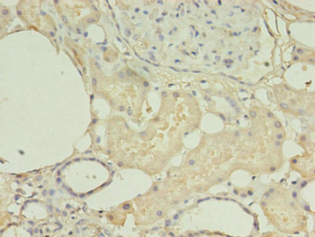 Immunohistochemistry of paraffin-embedded human kidney tissue using CSB-PA010612HA01HU at dilution of 1:100