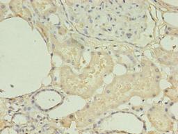 Immunohistochemistry of paraffin-embedded human kidney tissue using CSB-PA010612HA01HU at dilution of 1:100