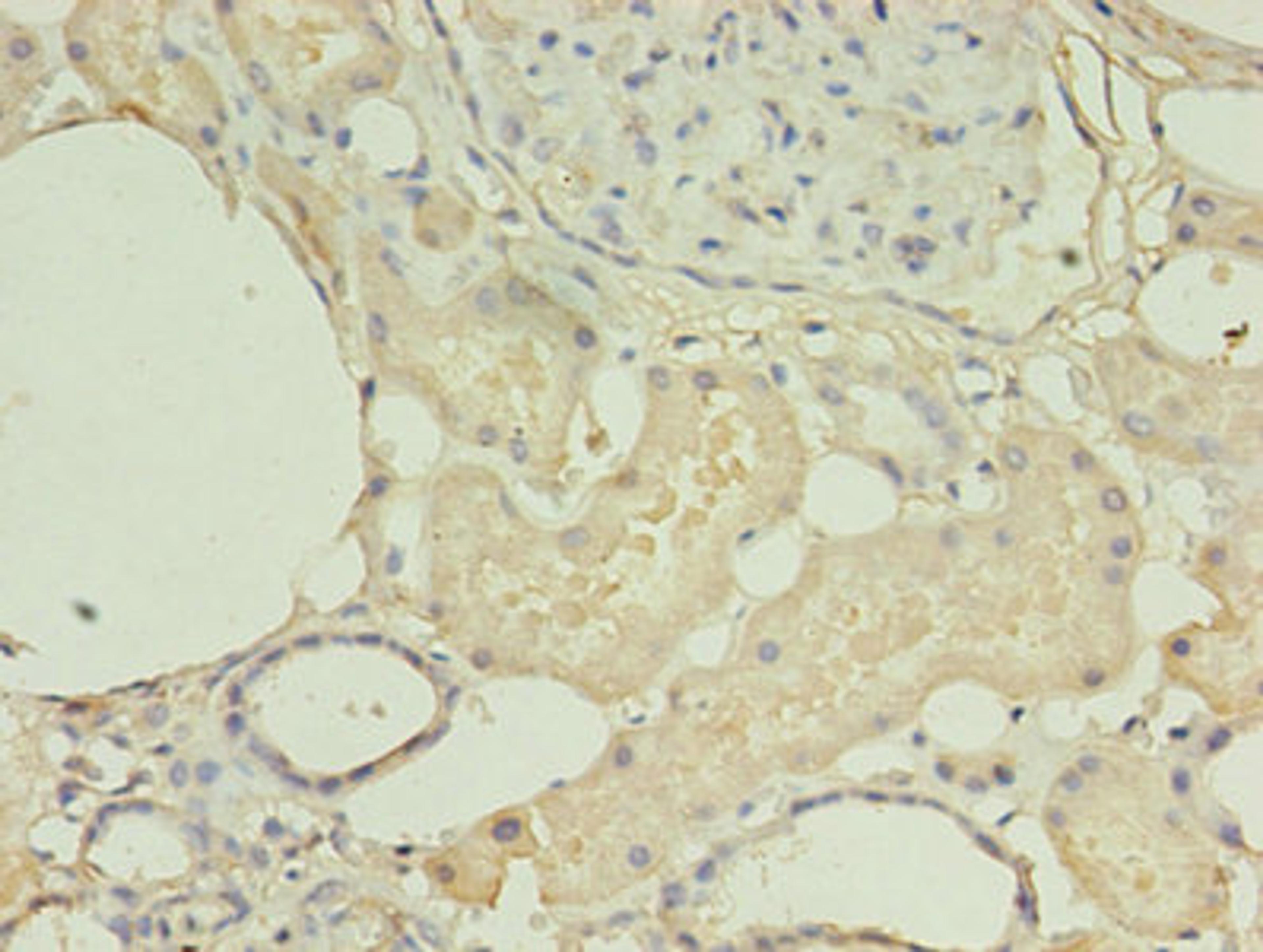 Immunohistochemistry of paraffin-embedded human kidney tissue using CSB-PA010612HA01HU at dilution of 1:100