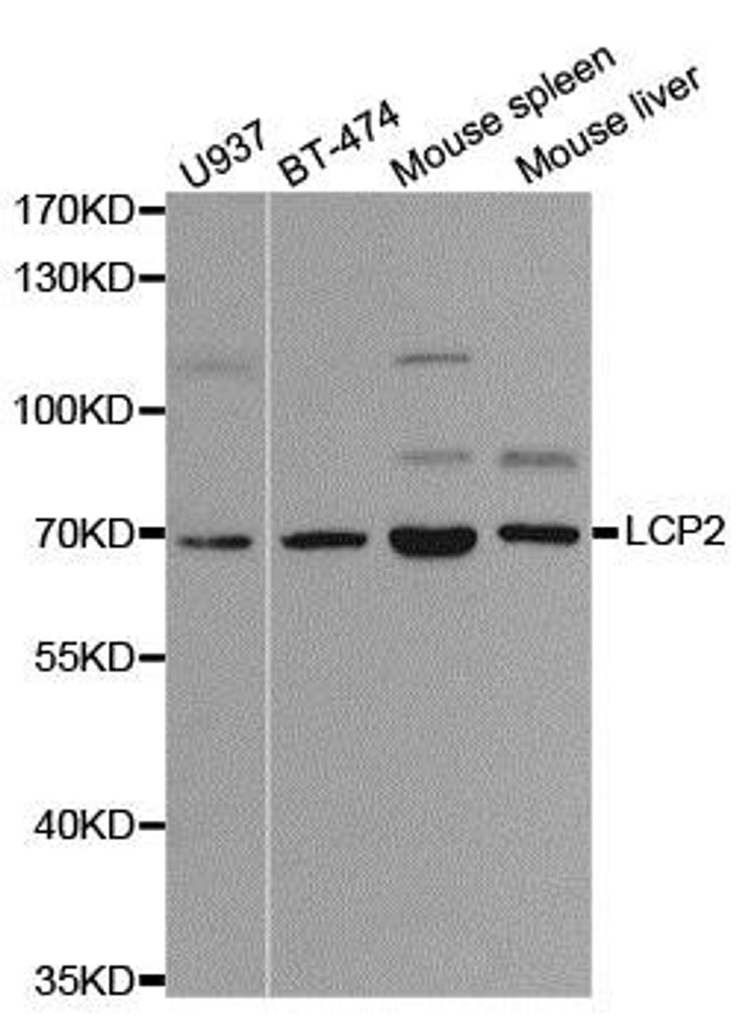 Western blot analysis of extracts of various cell lines using LCP2 antibody