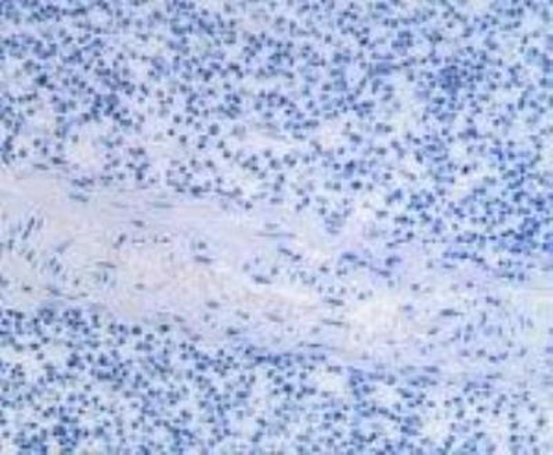 Immunohistochemistry: CD11c Antibody (AP-MAB0806) [NB110-97871] - Negative control