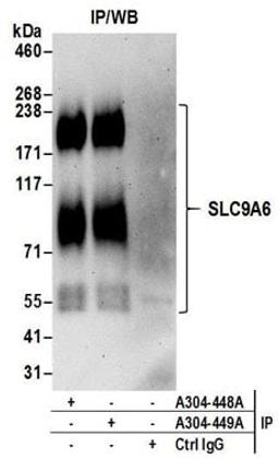 Detection of human SLC9A6 by western blot of immunoprecipitates.