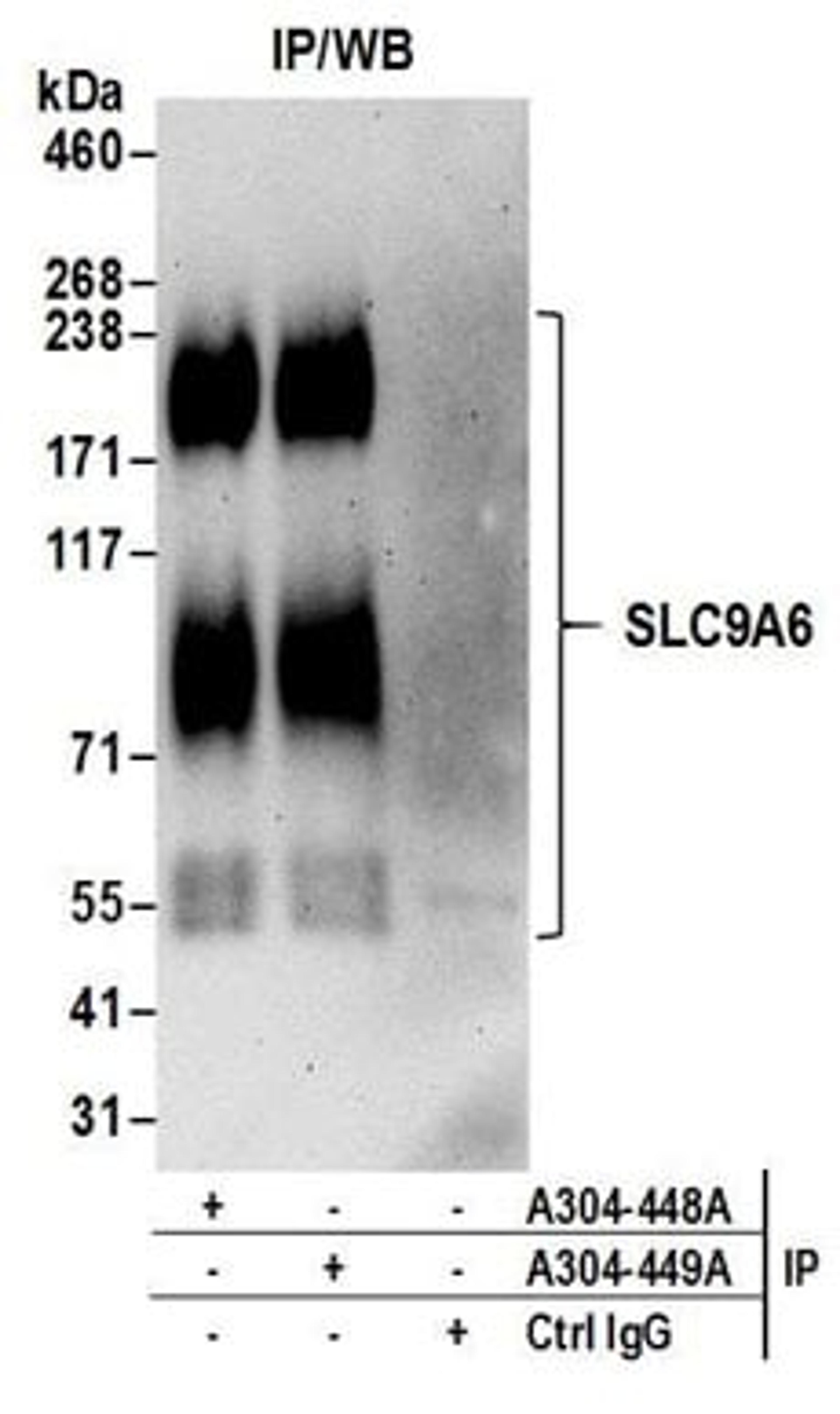 Detection of human SLC9A6 by western blot of immunoprecipitates.