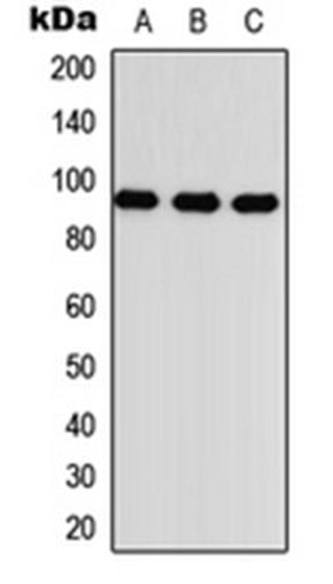 Western blot analysis of HEK293T (Lane 1), Raw264.7 (Lane 2), PC12 (Lane 3) whole cell lysates using TGFBR3 antibody