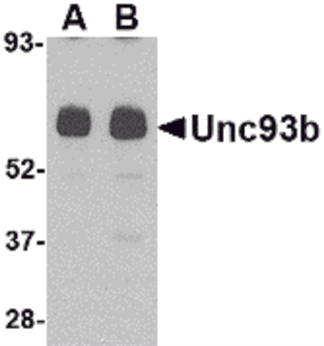 Western blot analysis of Unc93b in human heart tissue lysate with Unc93b antibody at (A) 0.5 and (B) 1 &#956;g/mL.