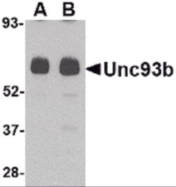 Western blot analysis of Unc93b in human heart tissue lysate with Unc93b antibody at (A) 0.5 and (B) 1 &#956;g/mL.