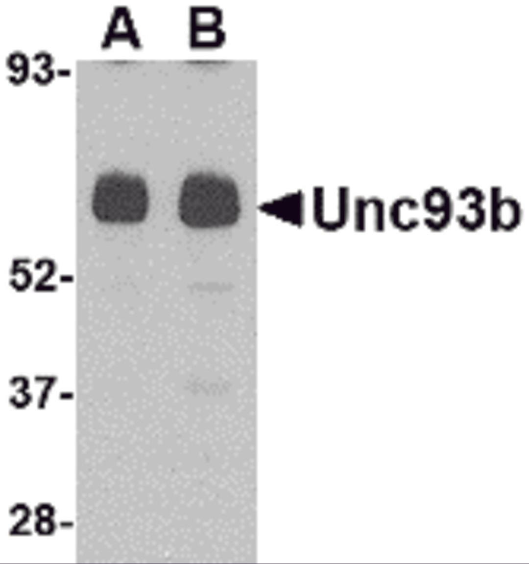 Western blot analysis of Unc93b in human heart tissue lysate with Unc93b antibody at (A) 0.5 and (B) 1 μg/mL.
