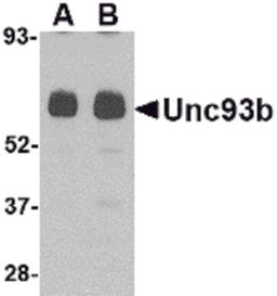Western blot analysis of Unc93b in human heart tissue lysate with Unc93b antibody at (A) 0.5 and (B) 1 μg/mL.