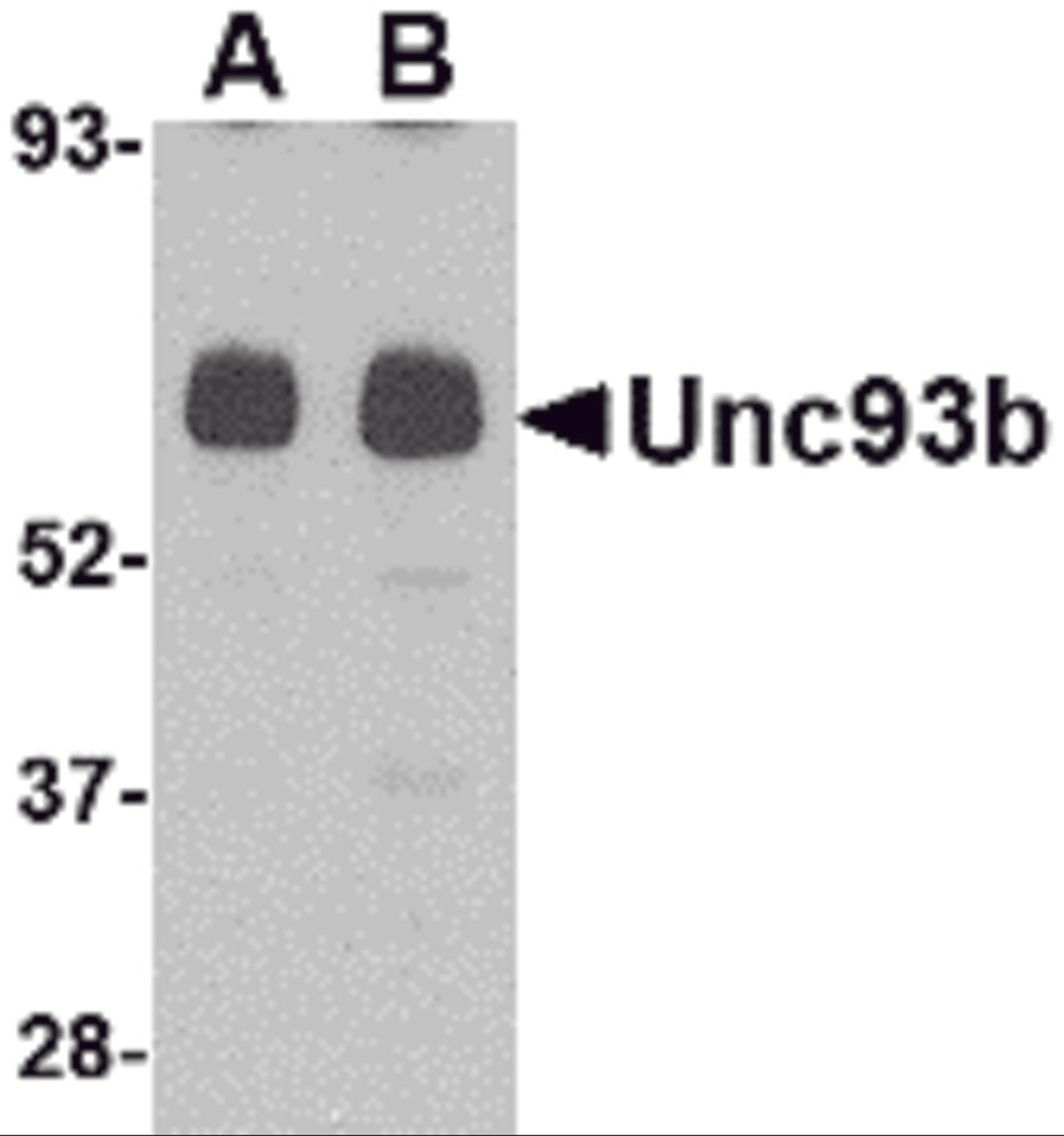 Western blot analysis of Unc93b in human heart tissue lysate with Unc93b antibody at (A) 0.5 and (B) 1 μg/mL.