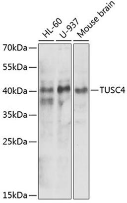 Western blot - NPRL2 antibody (A5859)