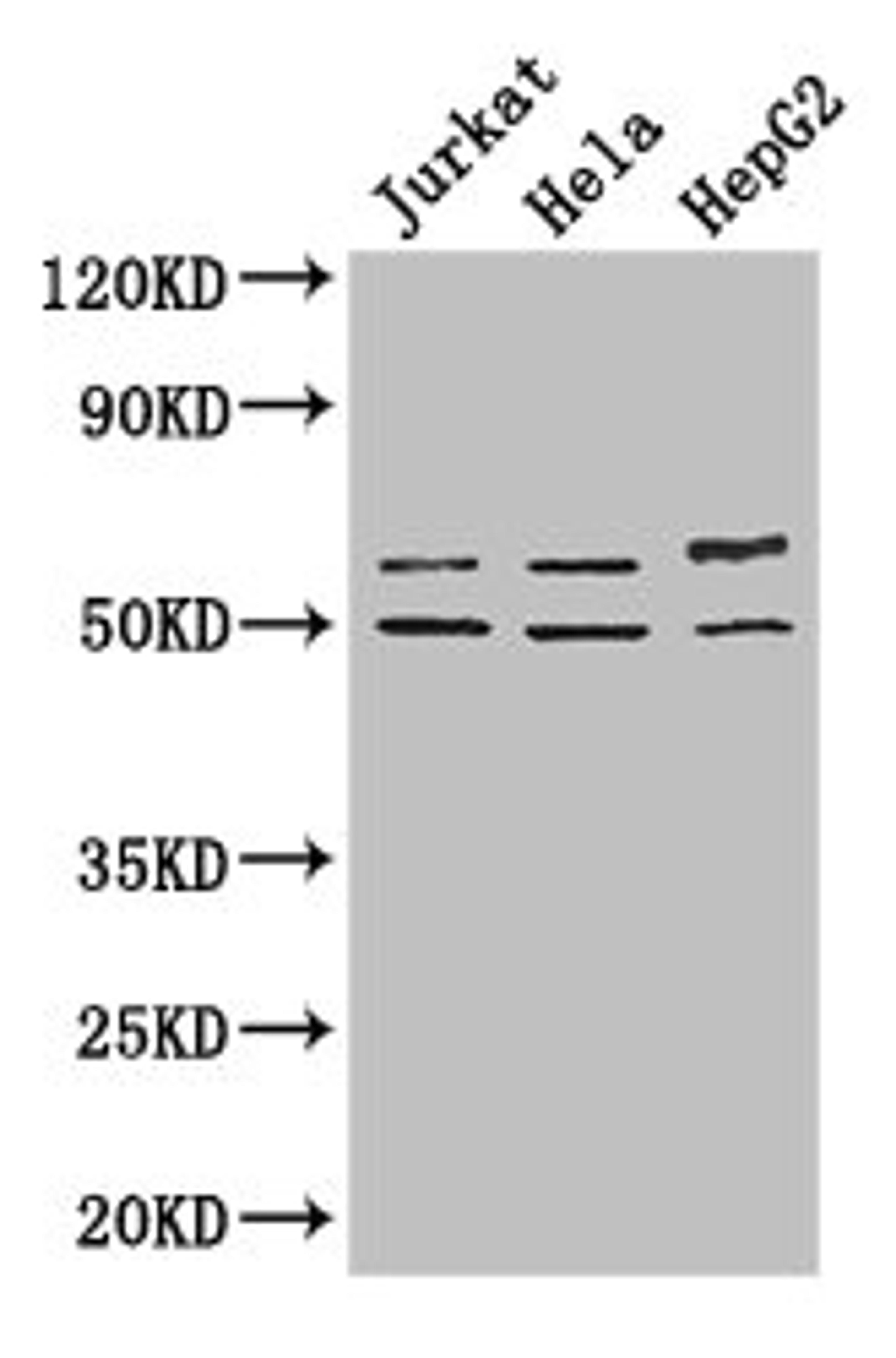 Western Blot. Positive WB detected in: Jurkat whole cell lysate, Hela whole cell lysate, HepG2 whole cell lysate. All lanes: YTHDF2 antibody at 2.7ug/ml. Secondary. Goat polyclonal to rabbit IgG at 1/50000 dilution. Predicted band size: 63, 57 kDa. Observed band size: 63, 50 kDa.