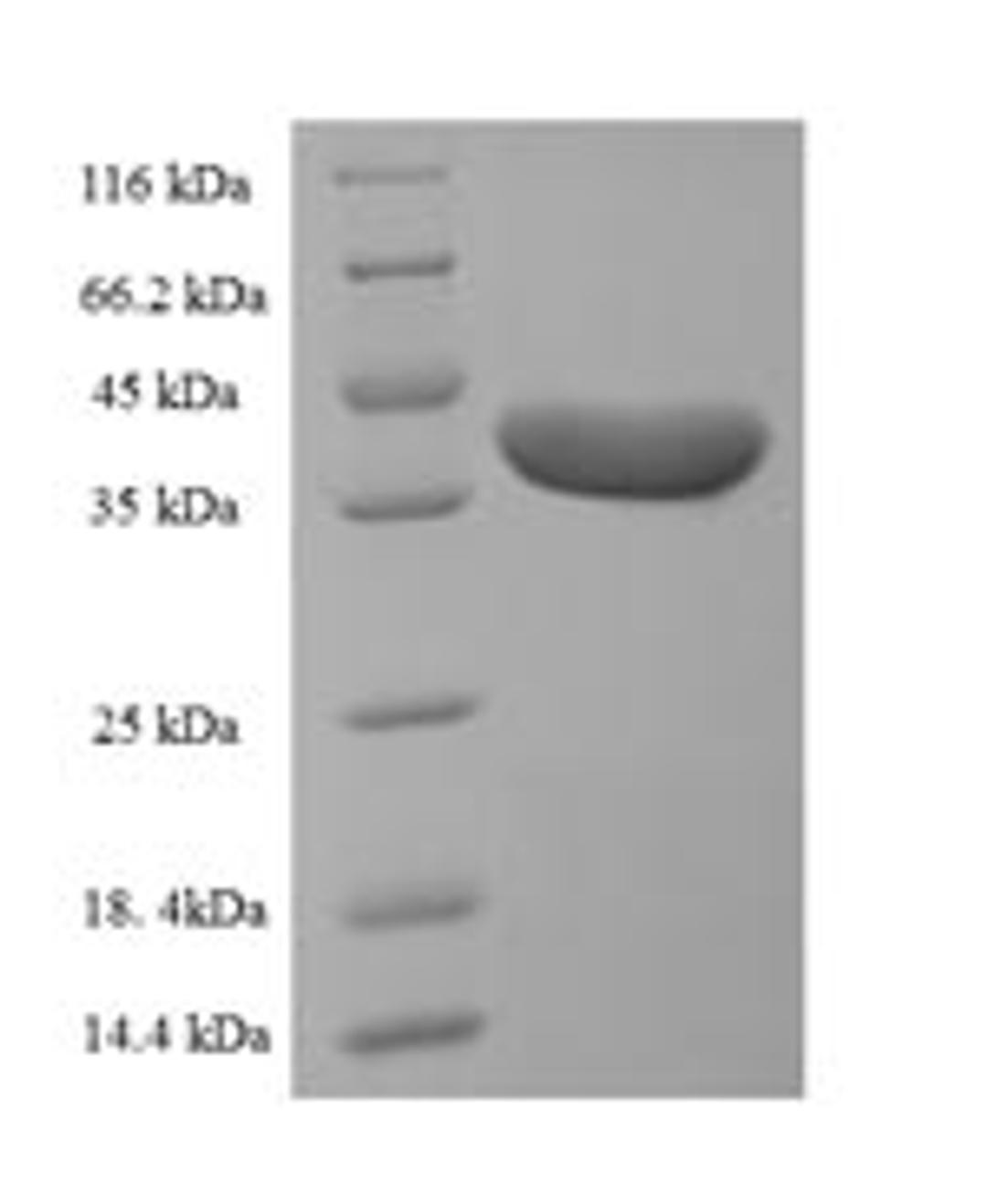 (Tris-Glycine gel) Discontinuous SDS-PAGE (reduced) with 5% enrichment gel and 15% separation gel.